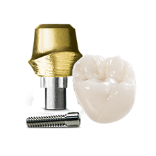 All-Inclusive Dental Implant Package