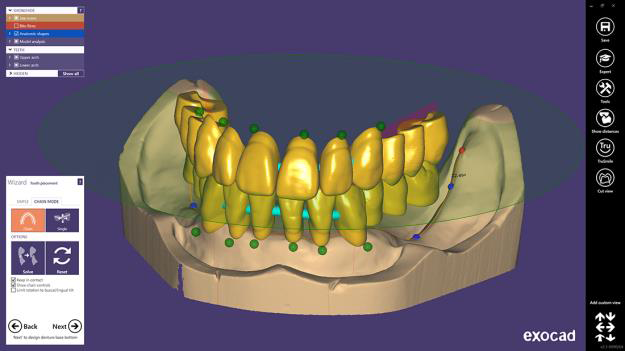 PMMA – Design & 3D Print